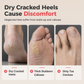🦶 PROMO FLASH : 50% DE RÉDUCTION ! Éliminateur de Callosités 3-en-1 – Pierre Ponce & Acier Inoxydable 304 for Des Pieds Lisses et Propres en 3 Étapes 🔧✨